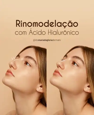 Post de moda da Formitz